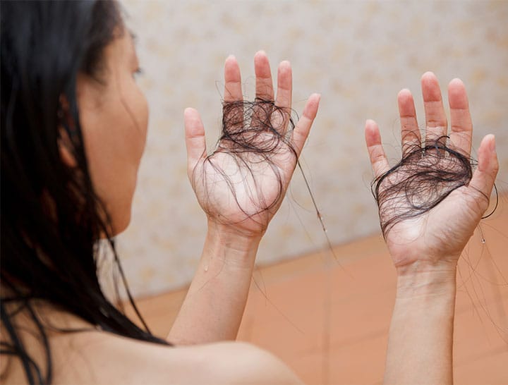 hair loss woman