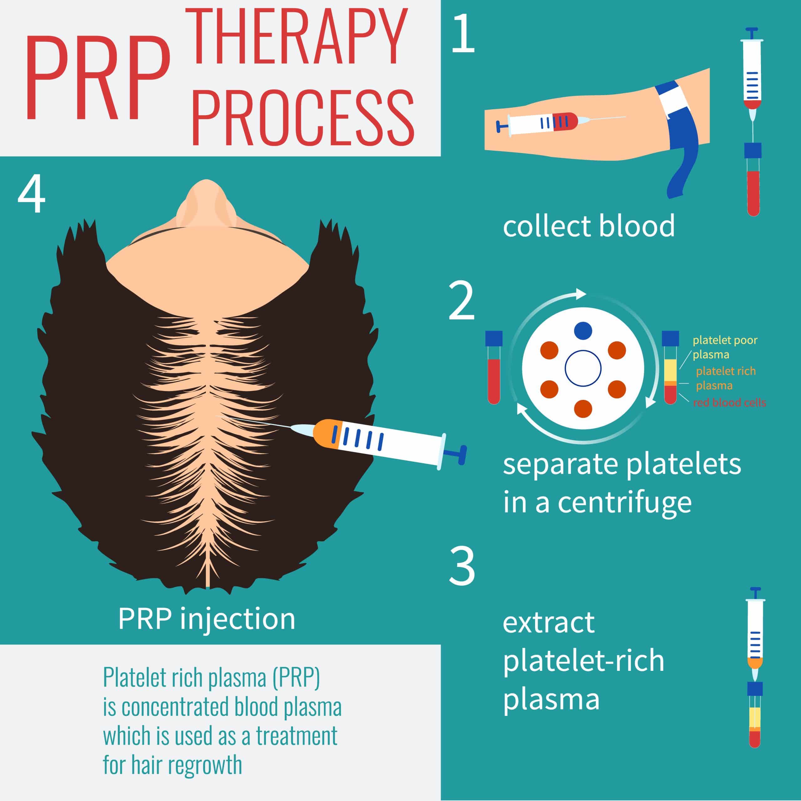 The PRP Therapy Process