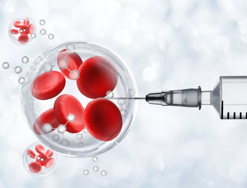 PRP Stem Cell Therapy