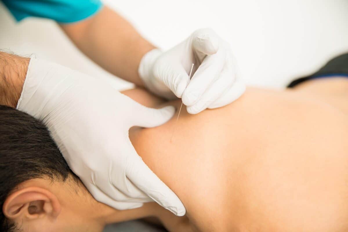 closeup-shirtless-man-receiving-dry-needling-therapy-from-doctor-clinic-1200x800.jpg